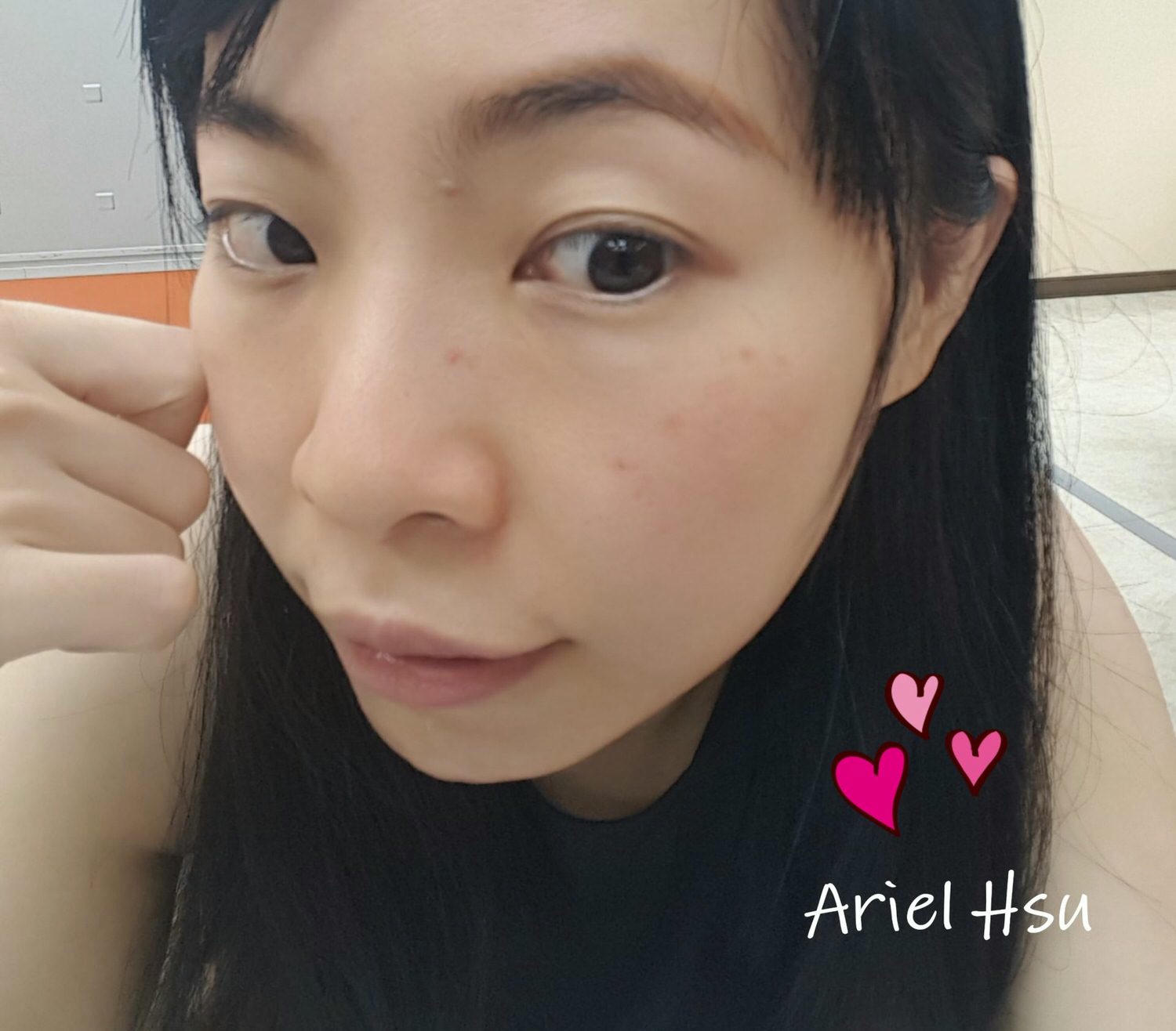 【醫美4】蜂巢皮秒雷射 Picosecond 紀錄感想、術後護理、多久打一次、皮秒雷射價格多少？